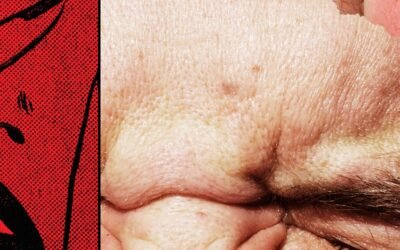 Why Skincare That Burns Is So Satisfying