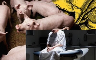 The Capitalist Trap of Pig Organ Transplants