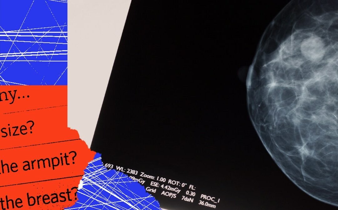 An AI Told Me I Had Cancer